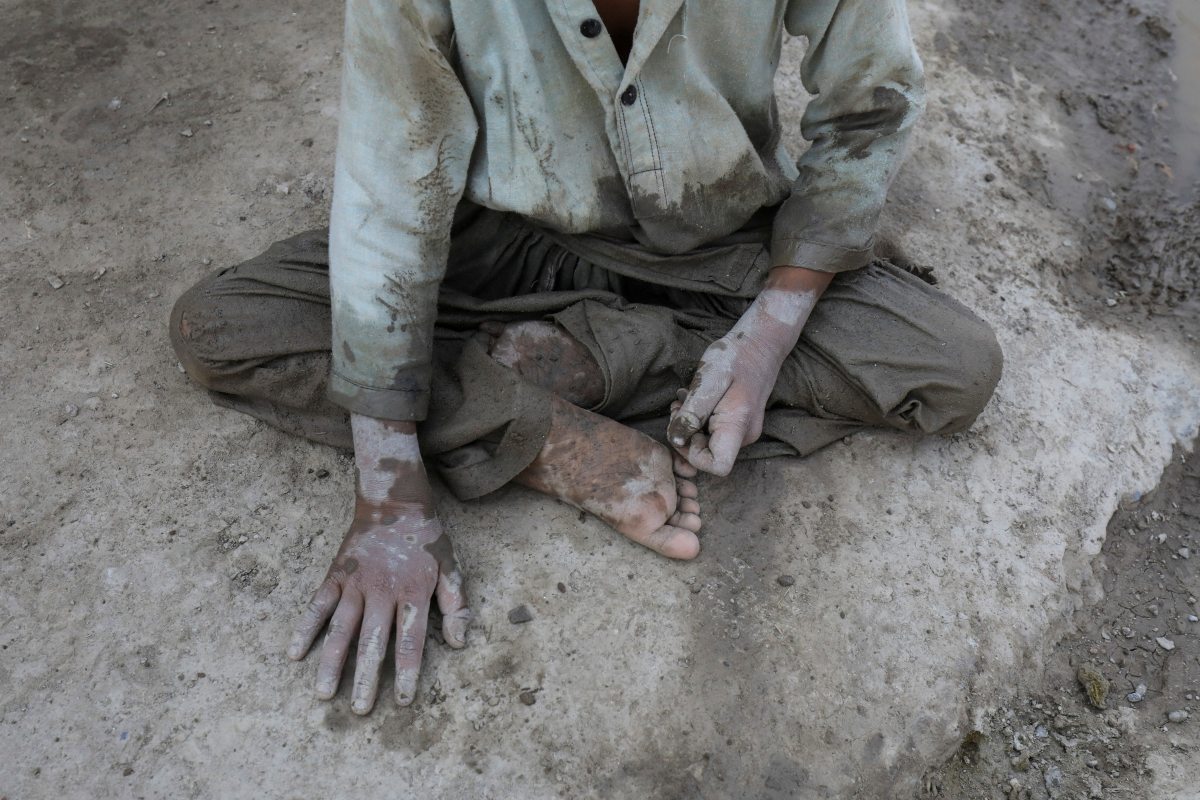 A boy with disability, sits and touches the floor with his hand, in partially wet and muddy cloths after he waded through flooded street, following rains and floods during the monsoon season in Nowshera