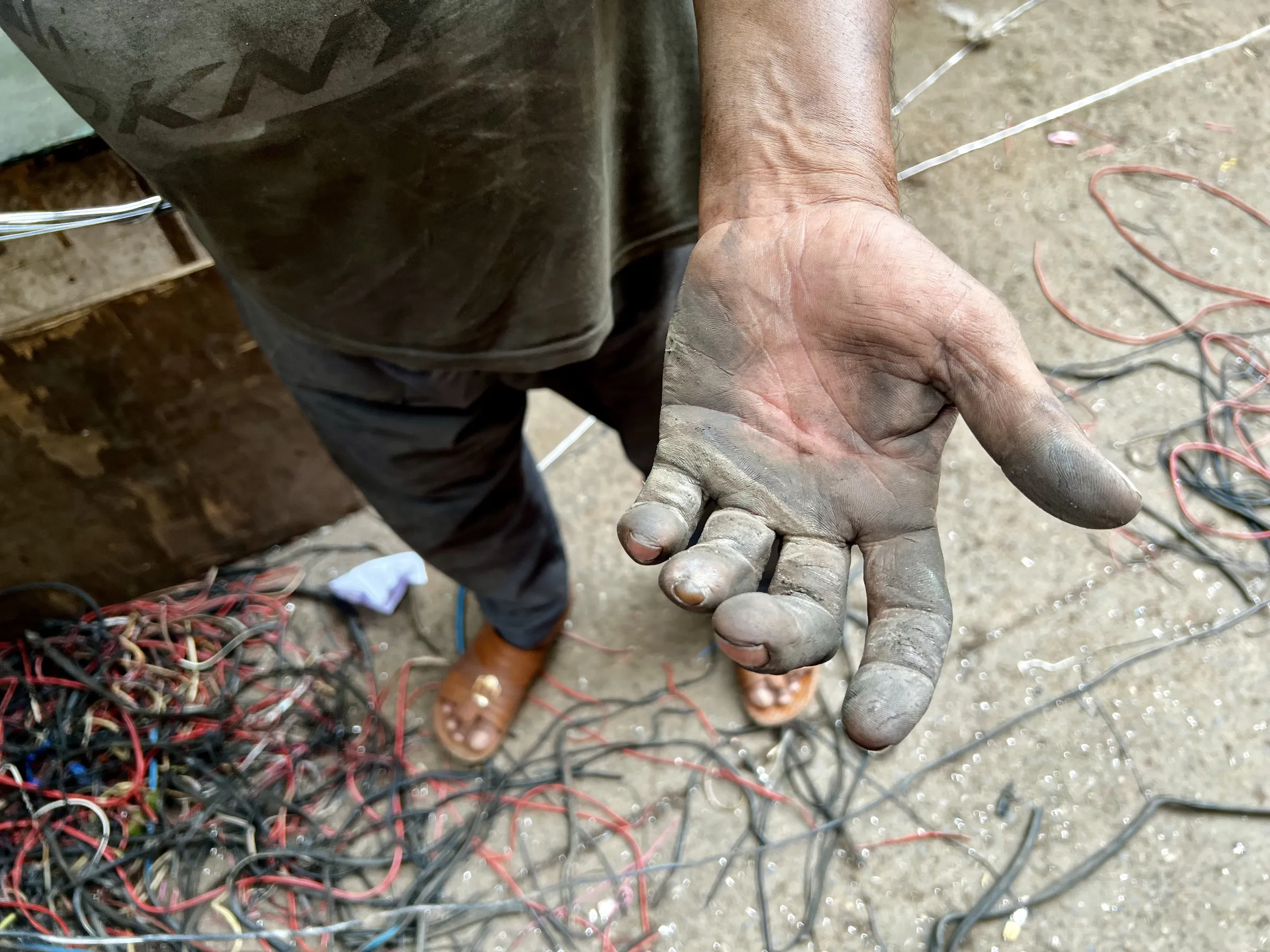 Mohammed Saleem, an informal e-waste recycling worker, shows his scarred and worn hands from years of peeling old wires in Seelampur, Delhi. July 12, 2025. Thomson Reuters Foundation/Bhasker Tripathi