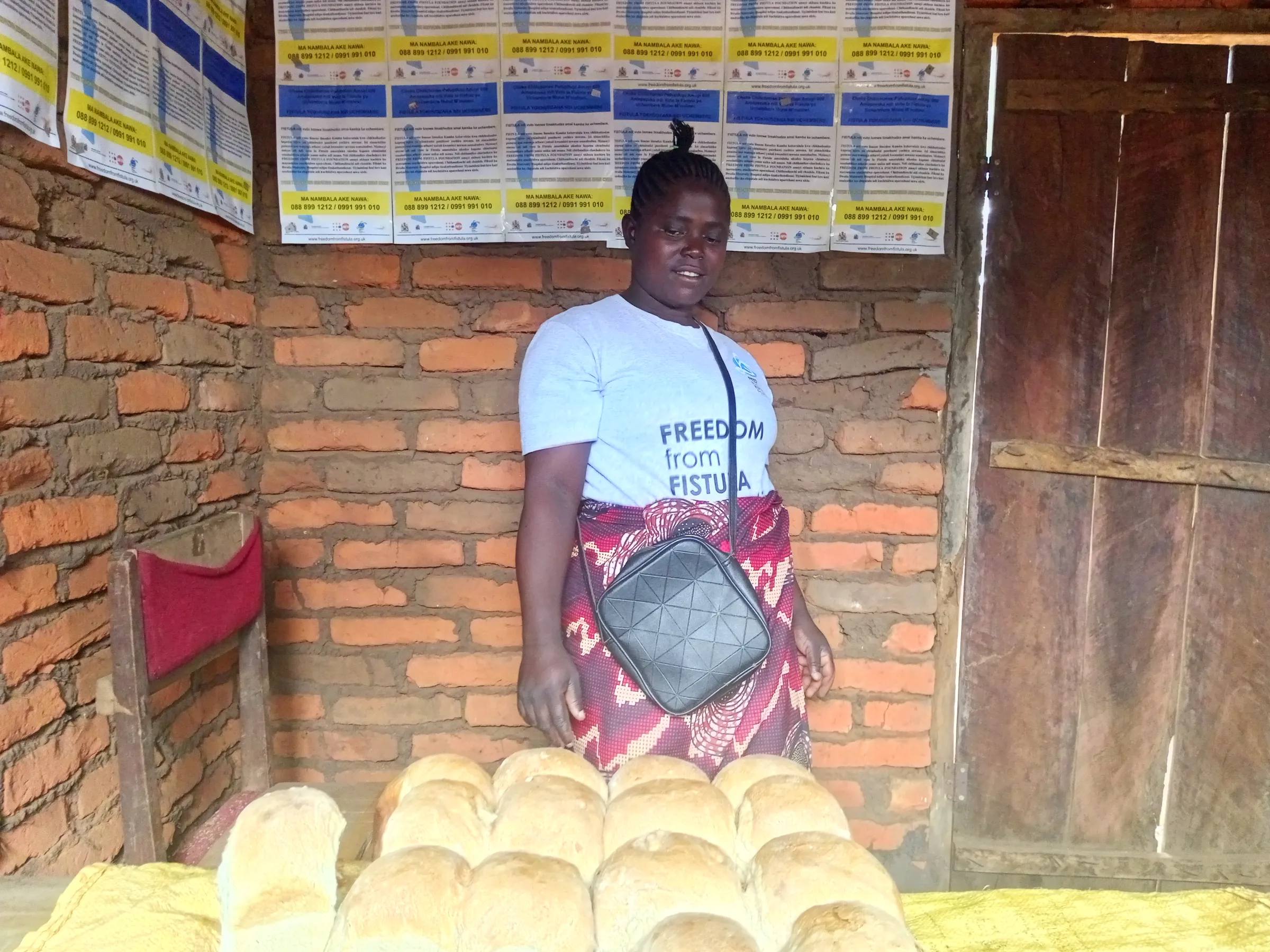 Alinafe Lloyd (31), a fistula  survivor, arranges freshly buns for the tea-room she runs with her husband, Lilongwe, Malawi, July 21, 2025.  Charles Pensulo/Thomson Reuters Foundation