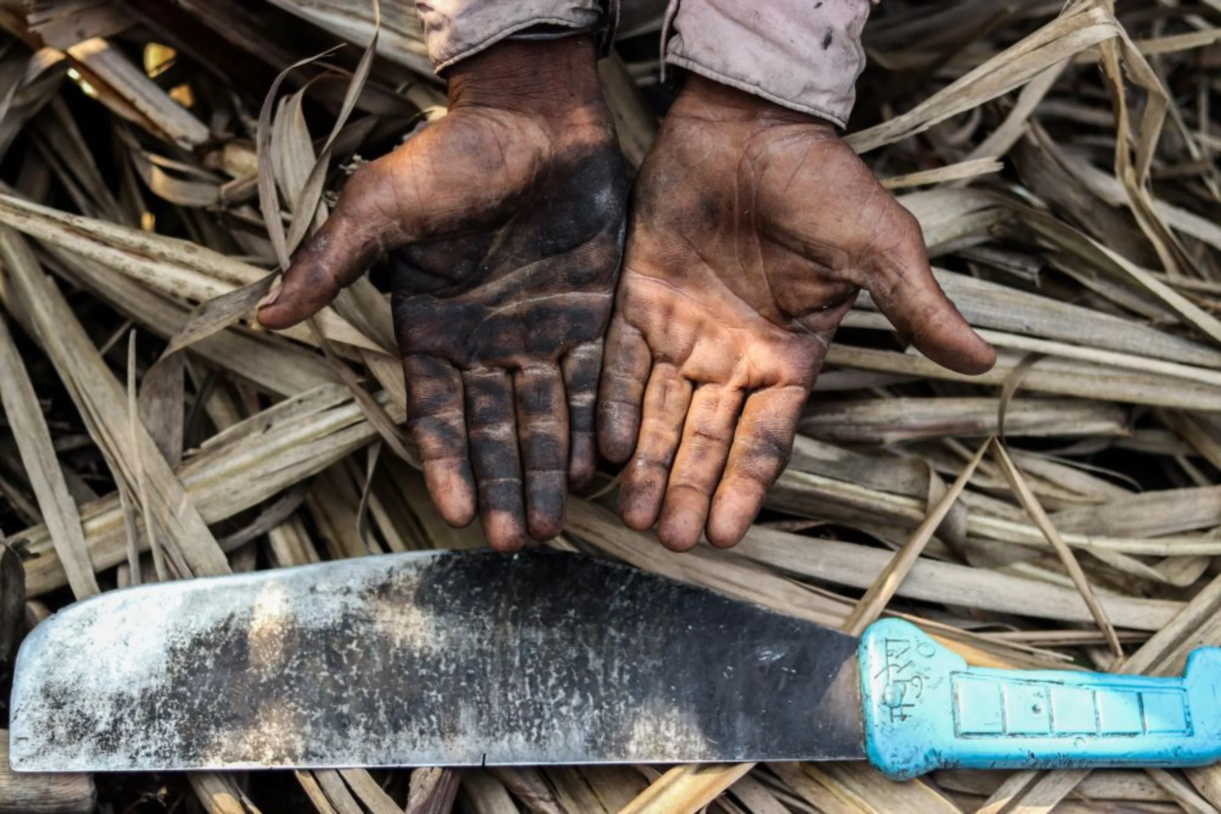 A sugarcane cutter showing his hands after working in the fields for several hours without any protective gear in a sugarcane field in in Maharashtra’s Khochi village, India. December 17, 2022