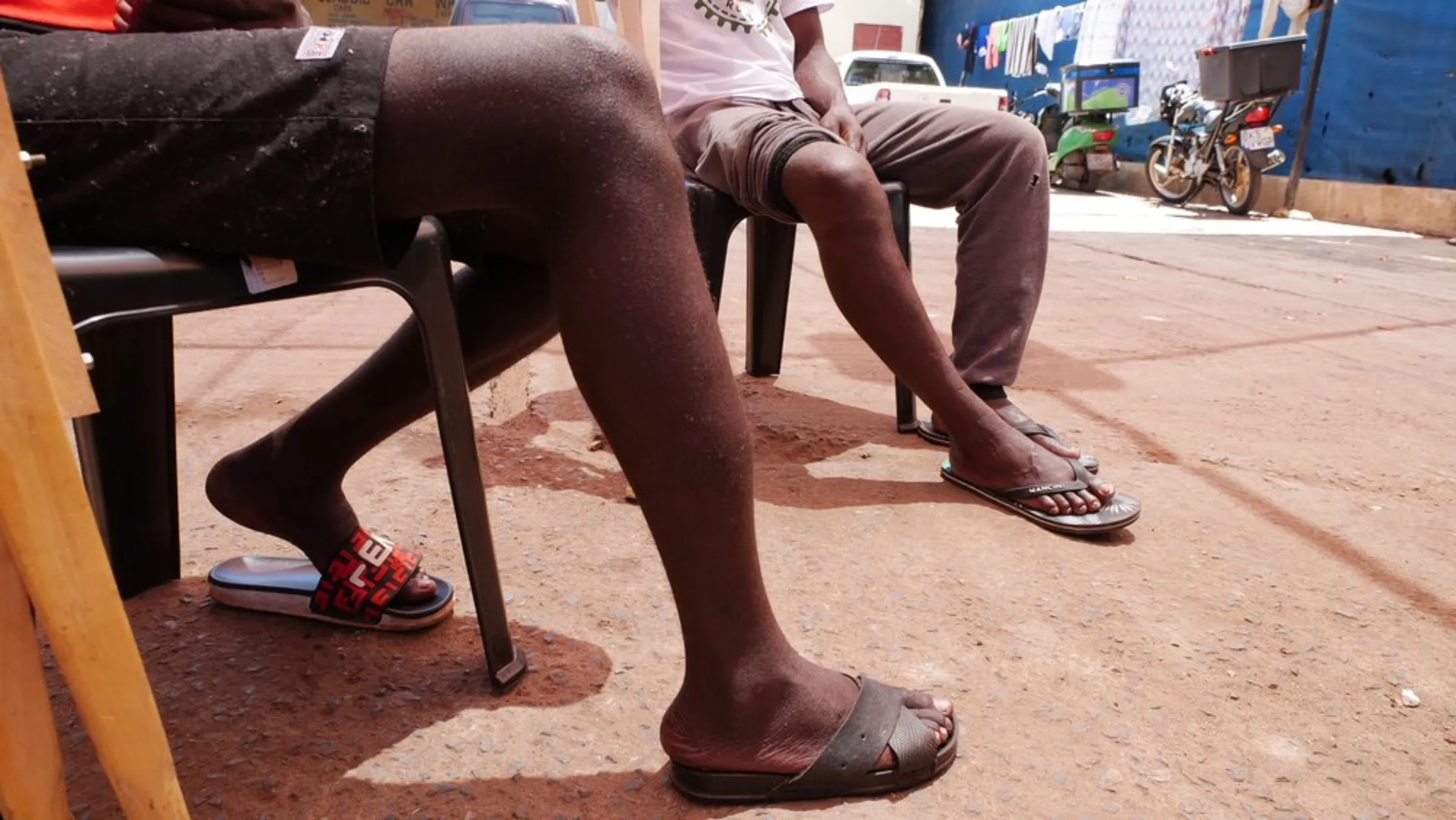 Two food delivery drivers point out their swollen legs following accidents while driving for Uber Eats in Johannesburg, South Africa. January 22, 2021. Thomson Reuters Foundation/Kim Harrisberg