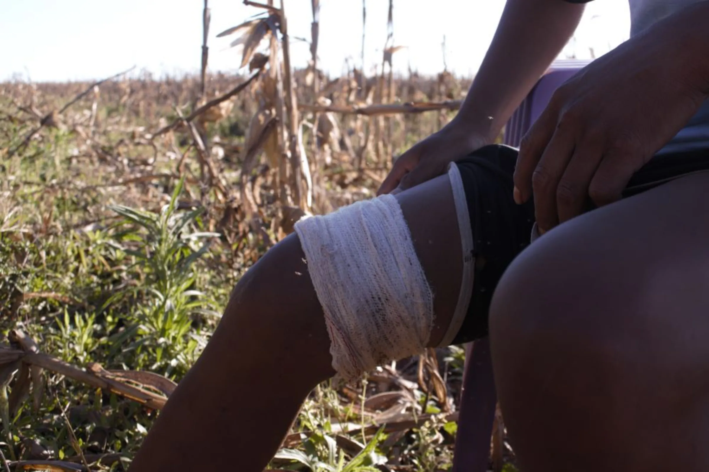 18 year old man who was shot at 17 through his right femur during a 24th of June Military Police raid sits in a corn field at the Guapoy occupation, near the Amambai Indigenous Reserve, in Amambai, Brazil, September, 17, 2022. Thomson Reuters Foundation/André Cabette Fábio