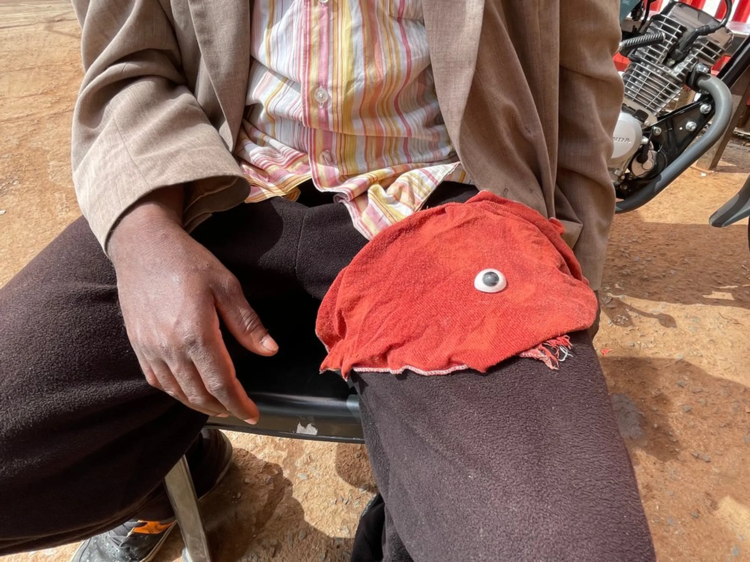 Former Uber Eats driver, Denis, places his synthetic eye on a cloth on his lap in a food courier commune where he lives in the south of Johannesburg, South Africa. He lost his eye and parts of his long-term memory after he was hit while driving for Uber and had to spend months recovering in hospital. 'The other drivers help feed and clothe me,' said Denis. March 22, 2021. Thomson Reuters Foundation/Kim Harrisberg