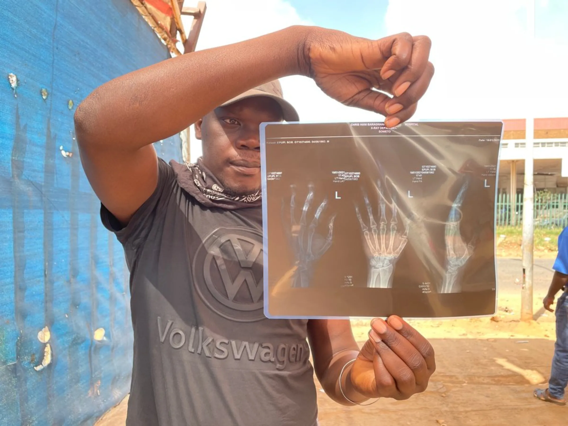 Food delivery driver, Bob, holds up the x-rays of his hand from an accident he was in while driving for Uber in Johannesburg, South Africa. He was unable to work for one month. March 22, 2021. Thomson Reuters Foundation/Kim Harrisberg