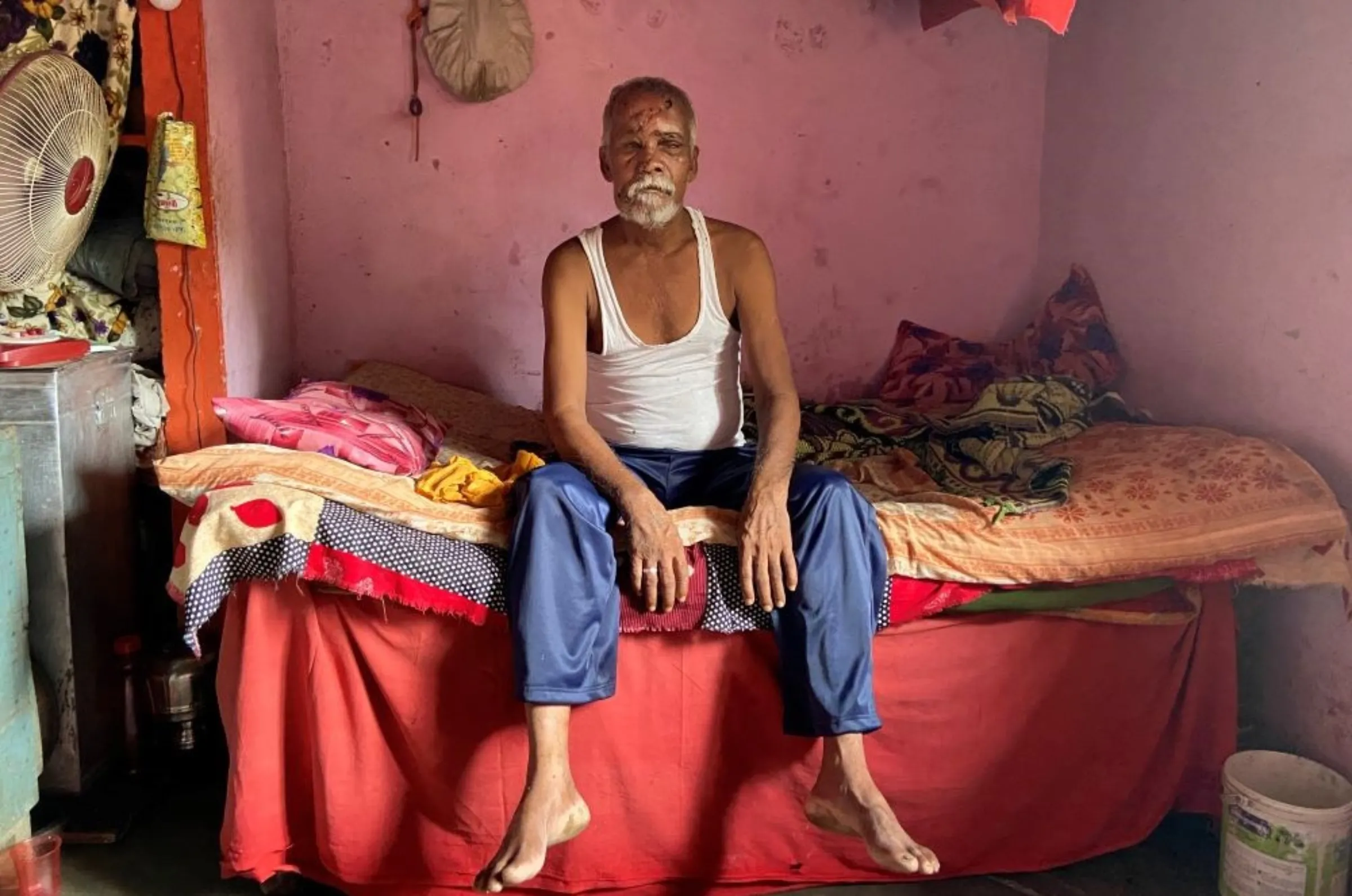 Bear attack victim Suresh Shankar Khiradkar poses for a picture at home in Payali Bhatali village in Chandrapur, India, August 19, 2021. Thomson Reuters Foundation/Roli Srivastava