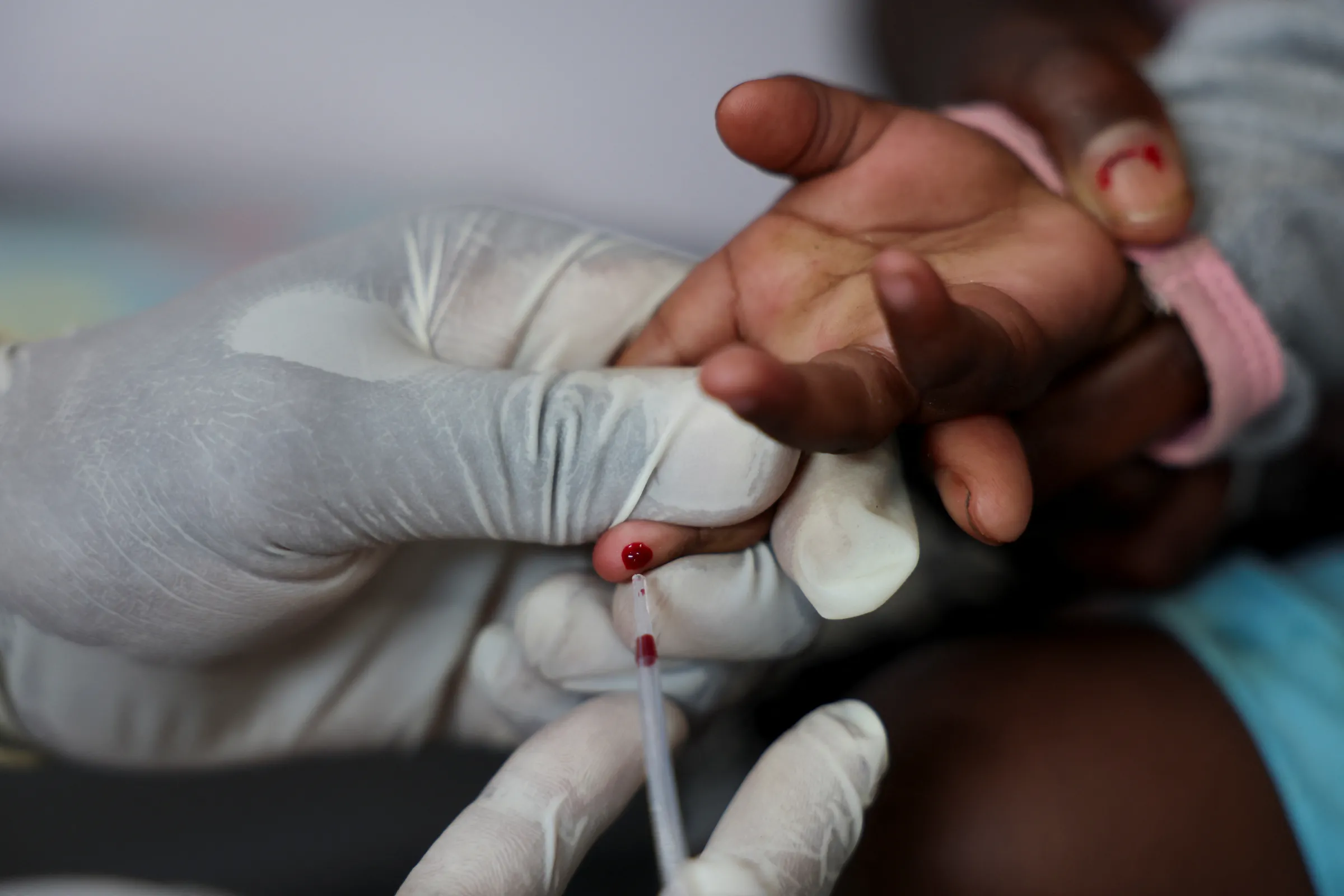 A nurse draws a blood sample from a child for an HIV test at a clinic in Diepsloot, north of Johannesburg, South Africa, March 12, 2025. REUTERS/Siphiwe Sibeko